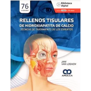 Rellenos tisulares de hidroxiapatita de calcio - Jani Van Loghem.